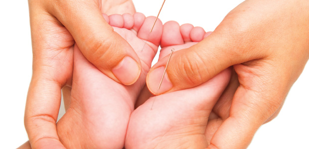 acupuncture-northern-beaches